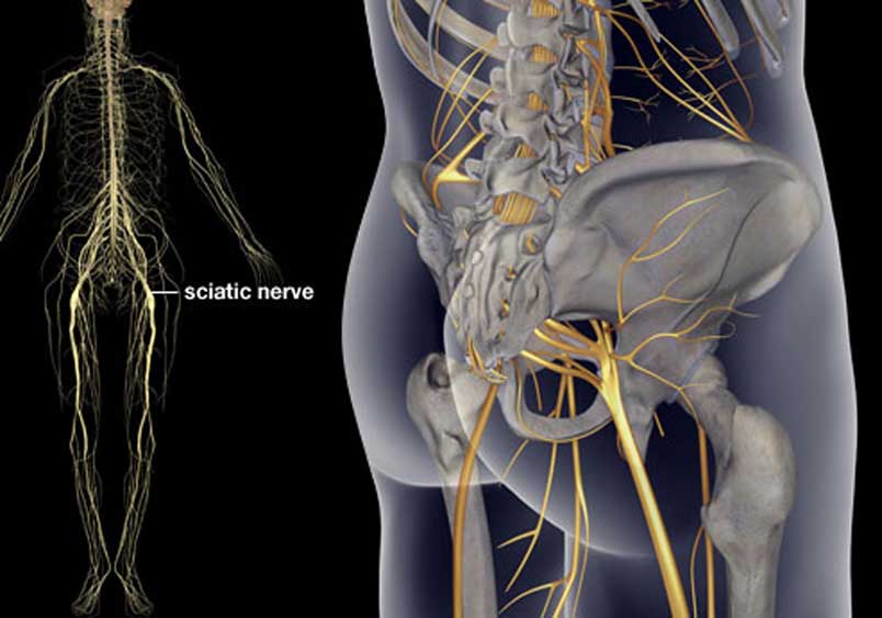 ilustração mostra o início do nervo ciático logo abaixo do quadril e sua extensão pela perna